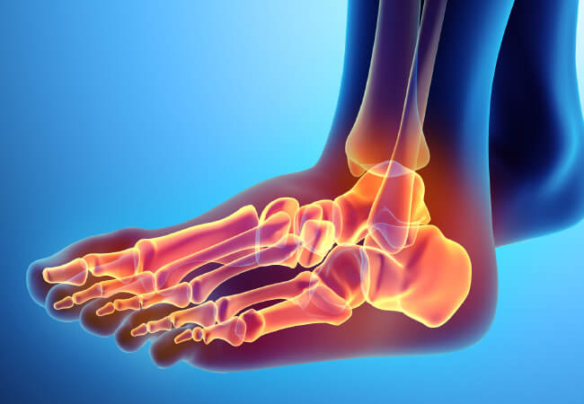 An anatomical illustration showing the bones of the human foot and ankle, essential for walking comfortably, with a gradient background.