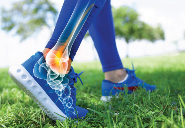 Illustration of foot biomechanics superimposed on an injury-free person coming back to walking in athletic shoes through physical therapy.