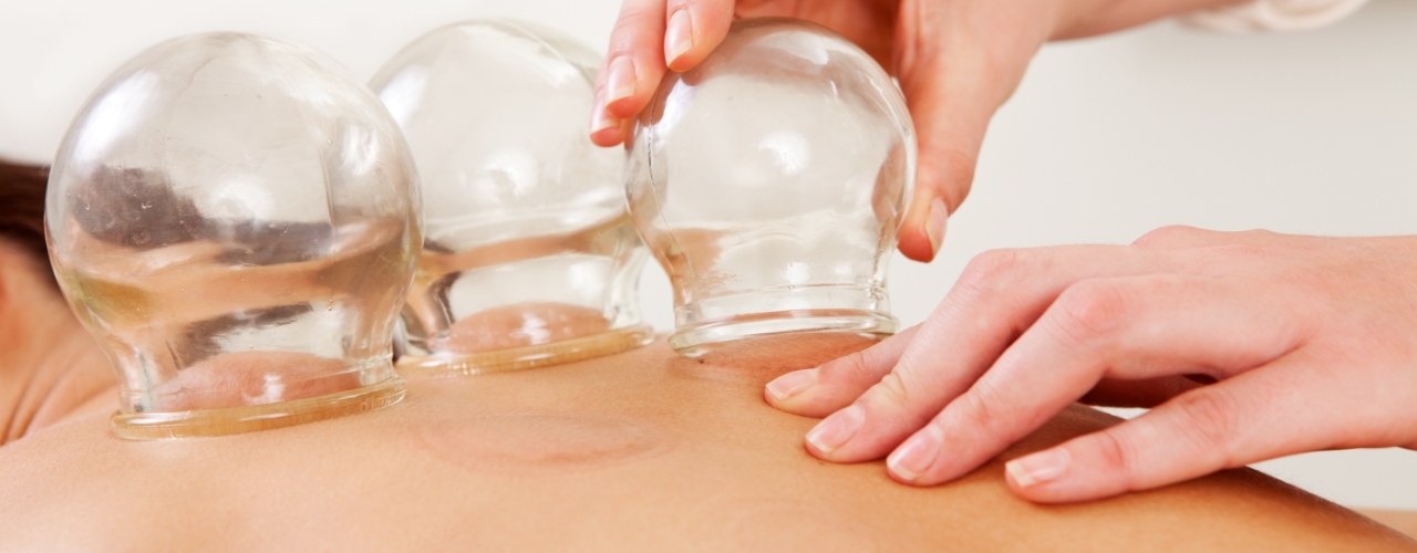 physical-therapy-clinic-cupping-agility-physical-therapy-venice-fl